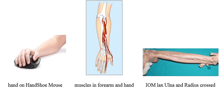 שרירי היד בשימוש בעכבר טופ קומרס